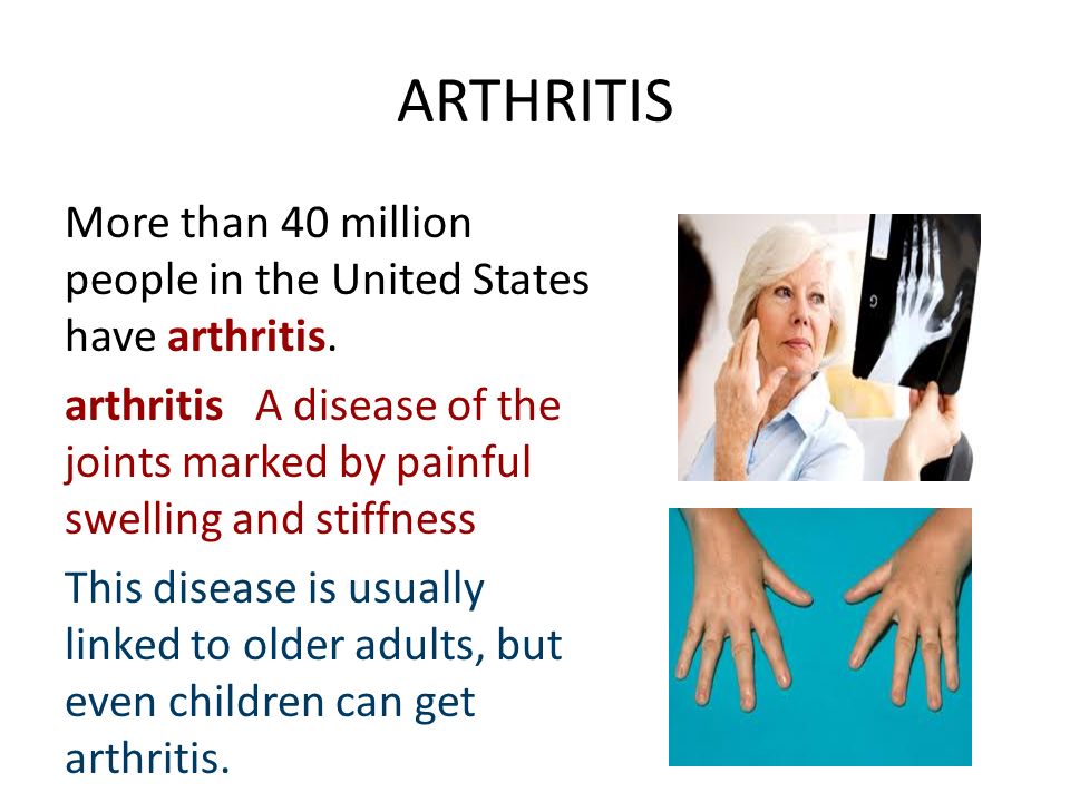 ARTHRITIS More than 40 million people in the United States have arthritis.