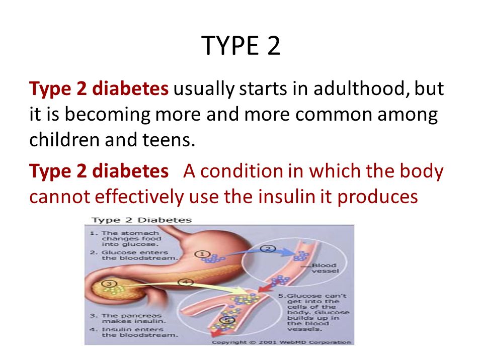 TYPE 2 Type 2 diabetes usually starts in adulthood, but it is becoming more and more common among children and teens.