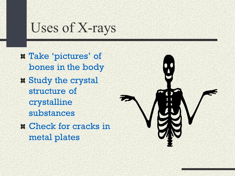 Uses of X-rays Take ‘pictures’ of bones in the body Study the crystal structure of crystalline substances Check for cracks in metal plates