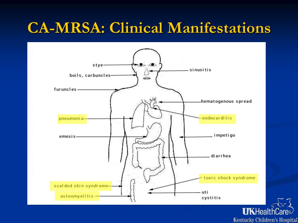 Mrsa Beyond Butt Boils Jeffrey S Bennett M D Assistant Professor Of Pediatrics Infectious Disease Director Section Of Inpatient Pediatrics University Ppt Download