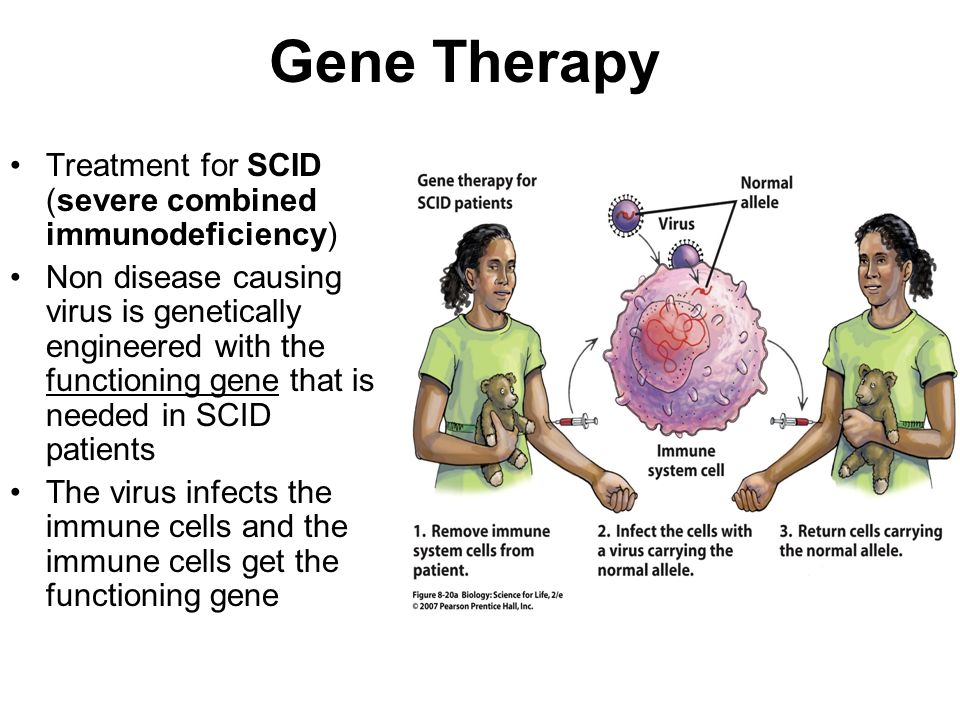 Gene Therapy Treatment for SCID (severe combined immunodeficiency) Non disease causing virus is genetically engineered with the functioning gene that is needed in SCID patients The virus infects the immune cells and the immune cells get the functioning gene