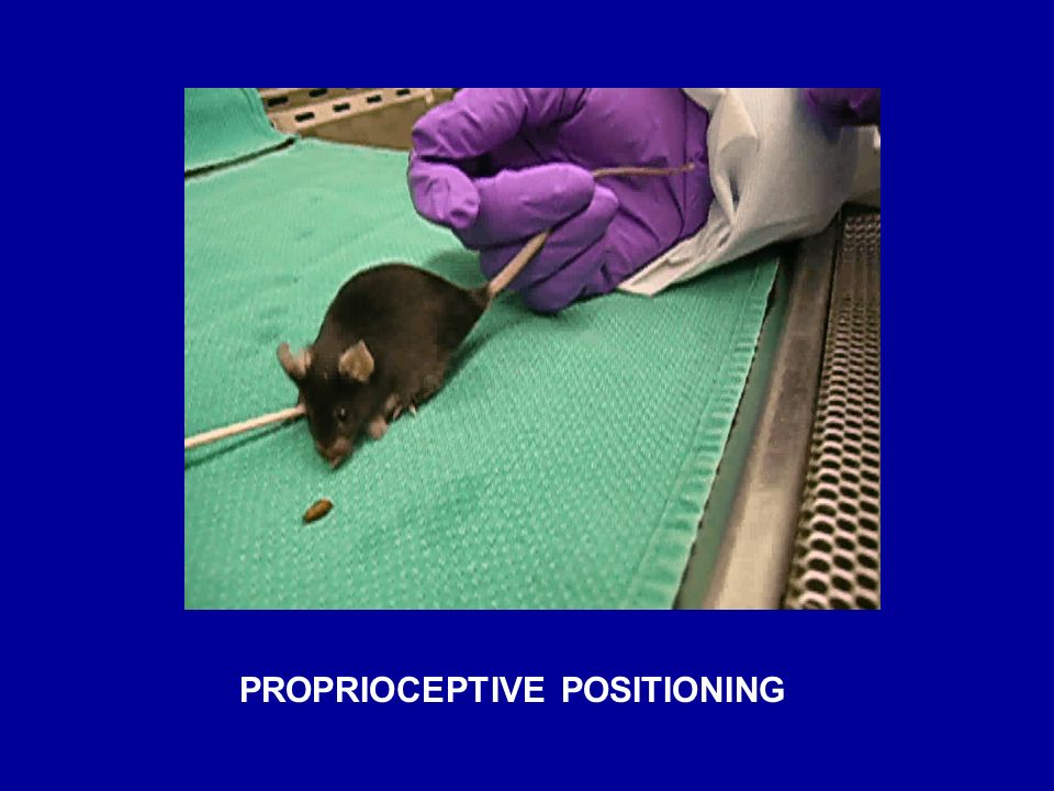 PROPRIOCEPTIVE POSITIONING