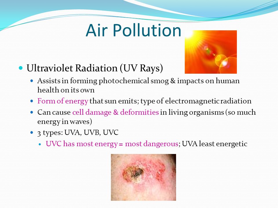 Air Pollution Ultraviolet Radiation (UV Rays) Assists in forming photochemical smog & impacts on human health on its own Form of energy that sun emits; type of electromagnetic radiation Can cause cell damage & deformities in living organisms (so much energy in waves) 3 types: UVA, UVB, UVC UVC has most energy = most dangerous; UVA least energetic