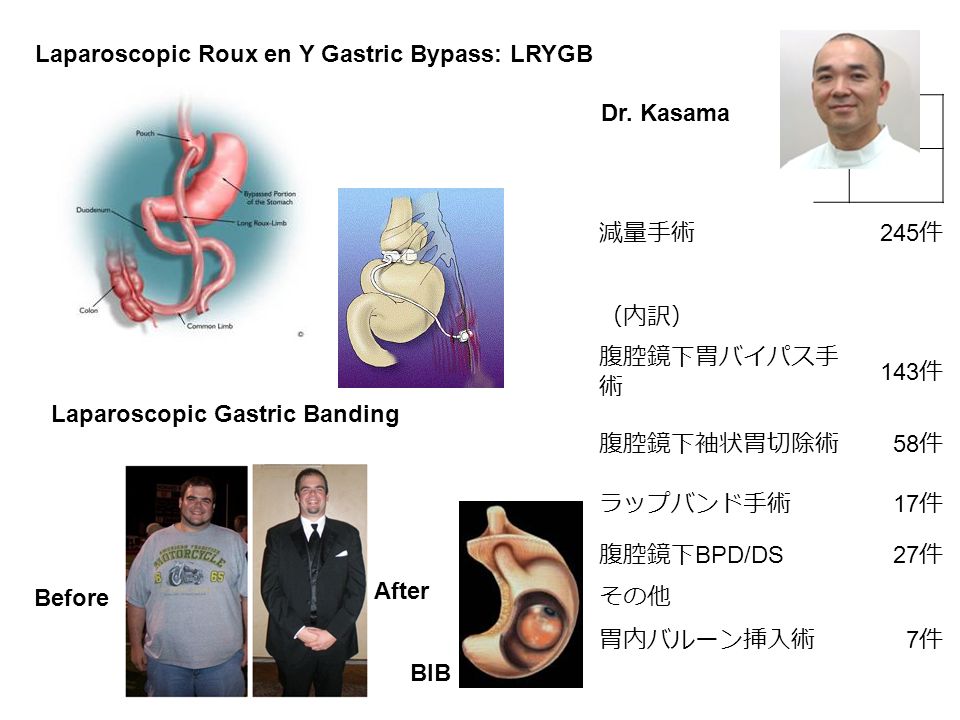 Journal Club 埼玉医科大学 総合医療センター 内分泌 糖尿病内科 Department Of Endocrinology And Diabetes Saitama Medical Center Saitama Medical University 松田 昌文 Matsuda Masafumi Ppt Download Journal Club 埼玉医科大学 総合医療センター 内分泌 糖尿病内科 Department Of Endocrinology And Diabetes Saitama Medical Center Saitama Medical University 松田 昌文 Matsuda Masafumi Ppt Download