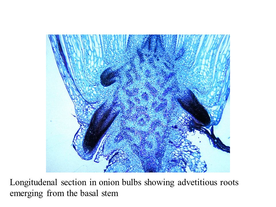 Longitudenal section in onion bulbs showing advetitious roots emerging from the basal stem