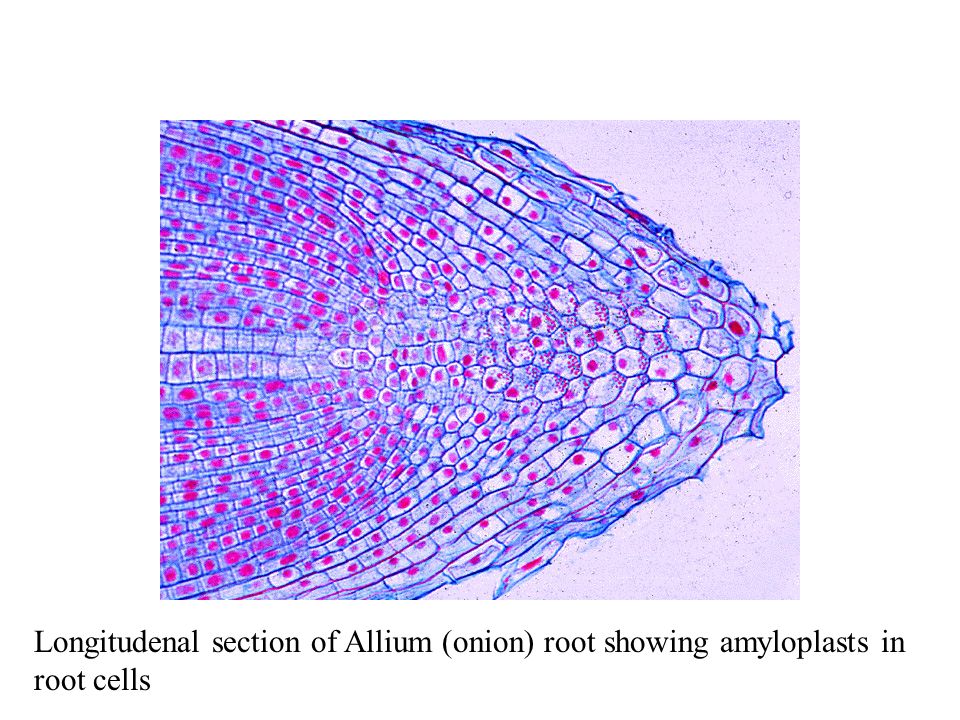 Longitudenal section of Allium (onion) root showing amyloplasts in root cells