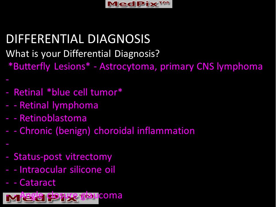 DIFFERENTIAL DIAGNOSIS What is your Differential Diagnosis.