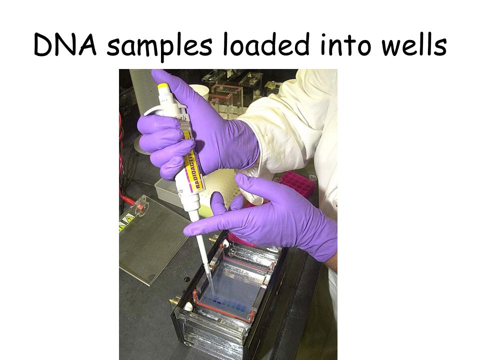 DNA samples loaded into wells