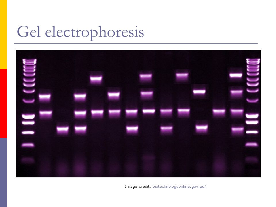 Gel electrophoresis Image credit: biotechnologyonline.gov.au/biotechnologyonline.gov.au/