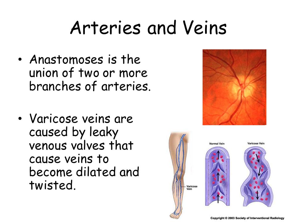 Arteries and Veins Anastomoses is the union of two or more branches of arteries.