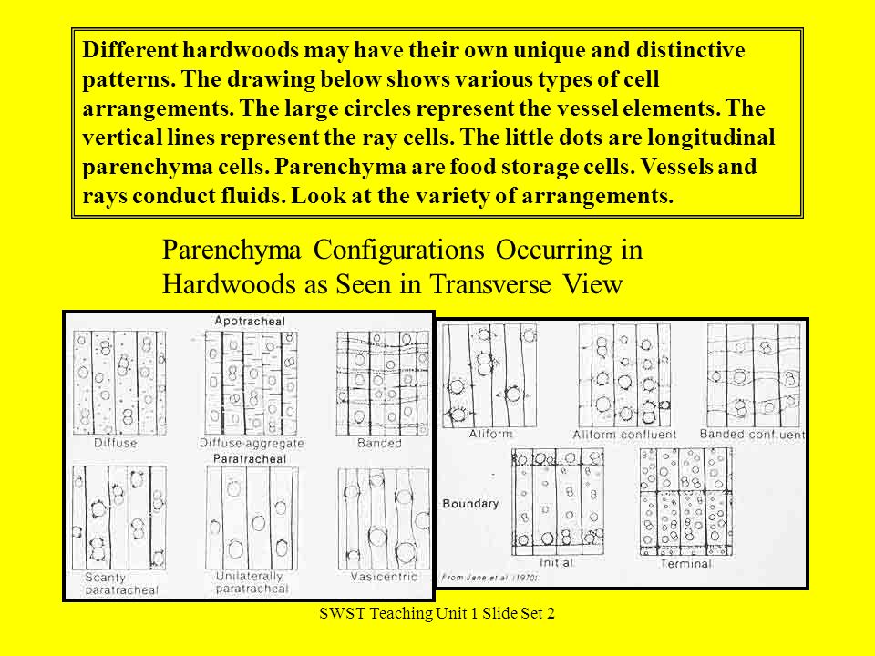 SWST Teaching Unit 1 Slide Set 2 Parenchyma Configurations Occurring in Hardwoods as Seen in Transverse View Different hardwoods may have their own unique and distinctive patterns.