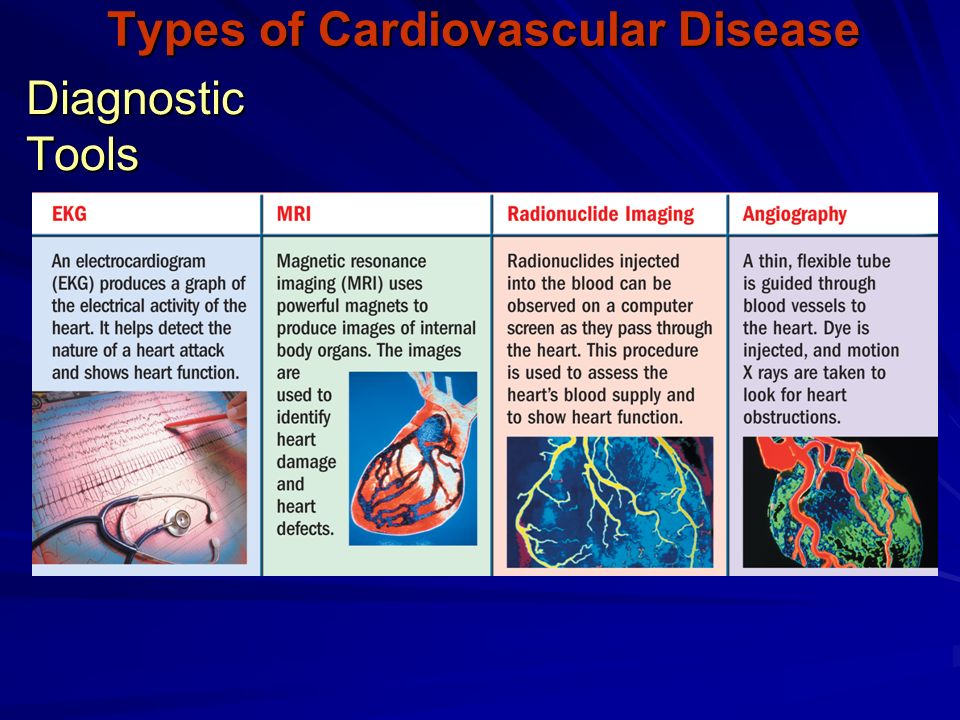 Diagnostic Tools Types of Cardiovascular Disease