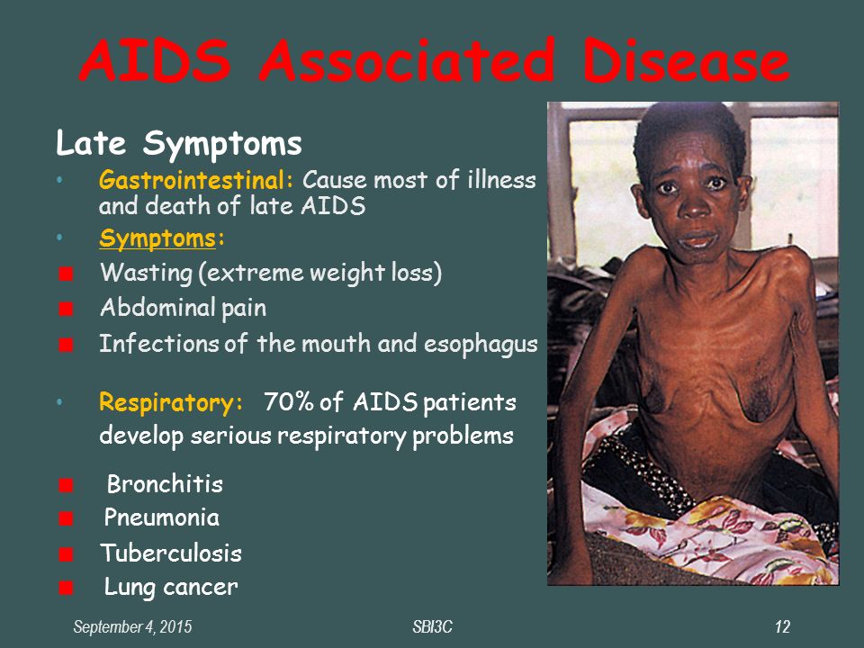 September 4, 2015SBI3C12SBI3C12 AIDS Associated Disease Late Symptoms Gastrointestinal: Cause most of illness and death of late AIDS Symptoms: Wasting (extreme weight loss) ‏ Abdominal pain Infections of the mouth and esophagus Respiratory: 70% of AIDS patients develop serious respiratory problems Bronchitis Pneumonia Tuberculosis Lung cancer
