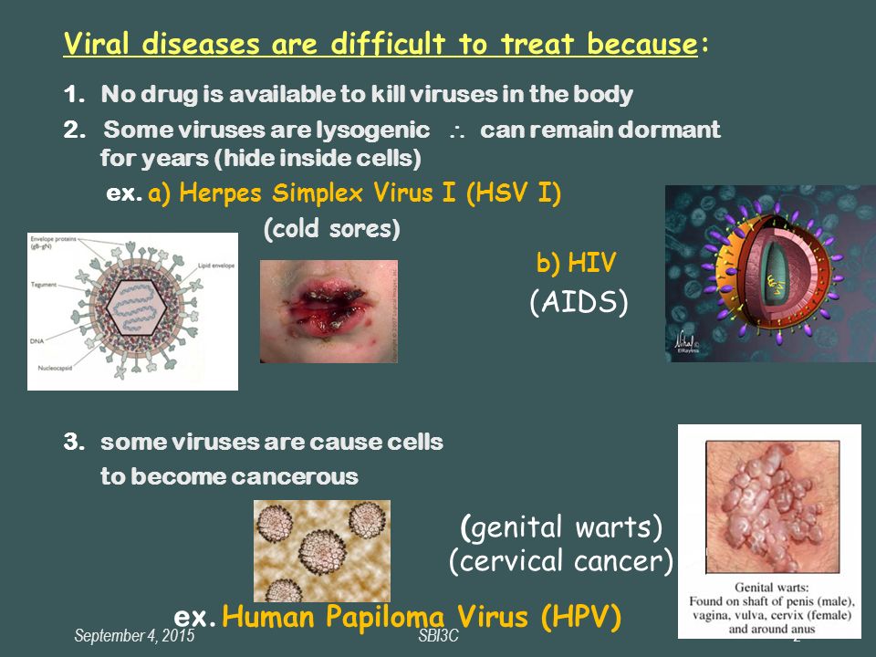September 4, 2015SBI3C2 Viral diseases are difficult to treat because: 1.No drug is available to kill viruses in the body 2.