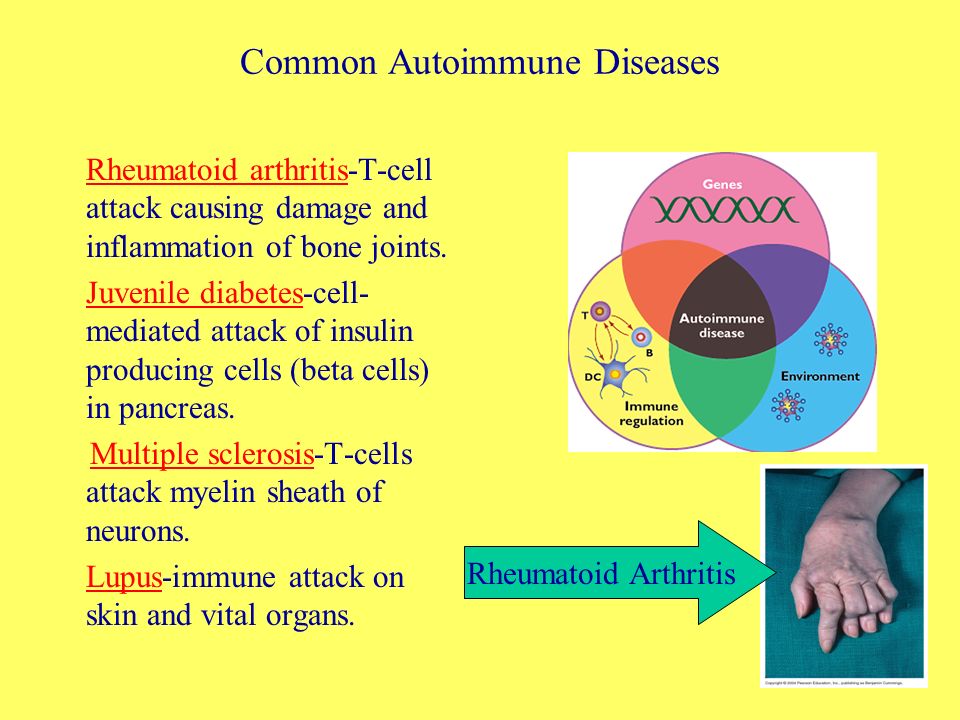 multiple sclerosis and rheumatoid arthritis are examples of this type of immune imbalance rheumatoid arthritis multiple sclerosis symptoms