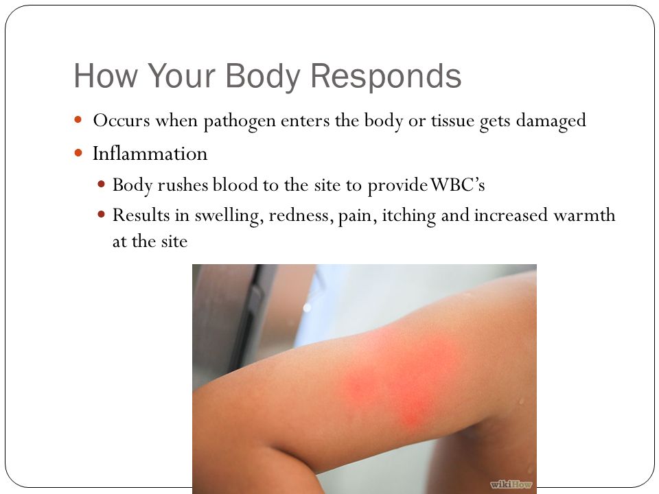 How Your Body Responds Occurs when pathogen enters the body or tissue gets damaged Inflammation Body rushes blood to the site to provide WBC’s Results in swelling, redness, pain, itching and increased warmth at the site