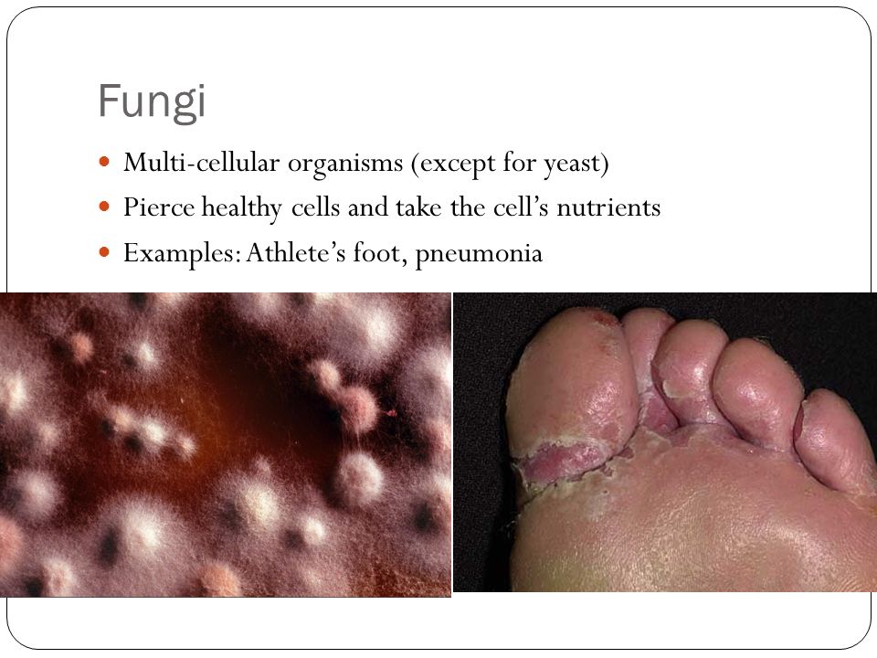 Fungi Multi-cellular organisms (except for yeast) Pierce healthy cells and take the cell’s nutrients Examples: Athlete’s foot, pneumonia