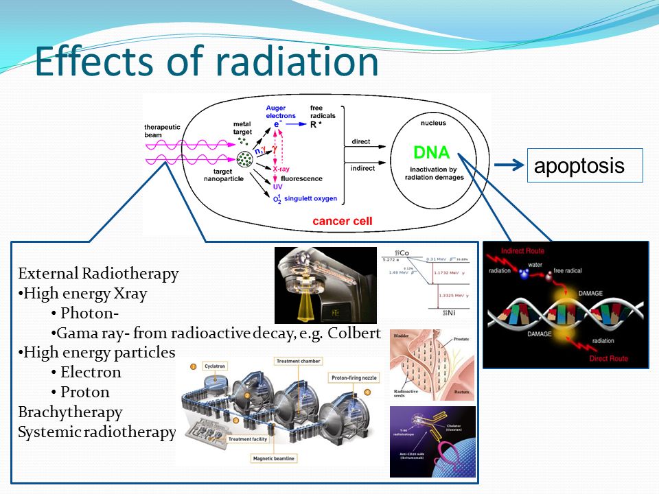 Effects of radiation External Radiotherapy High energy Xray Photon- Gama ray- from radioactive decay, e.g.