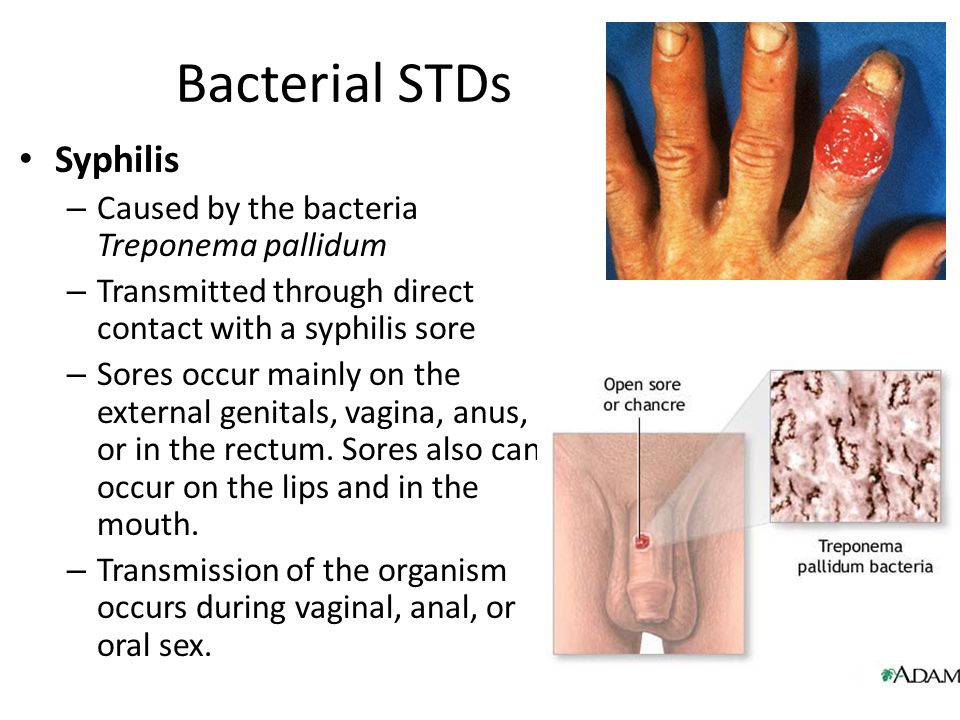 stds from anal sex