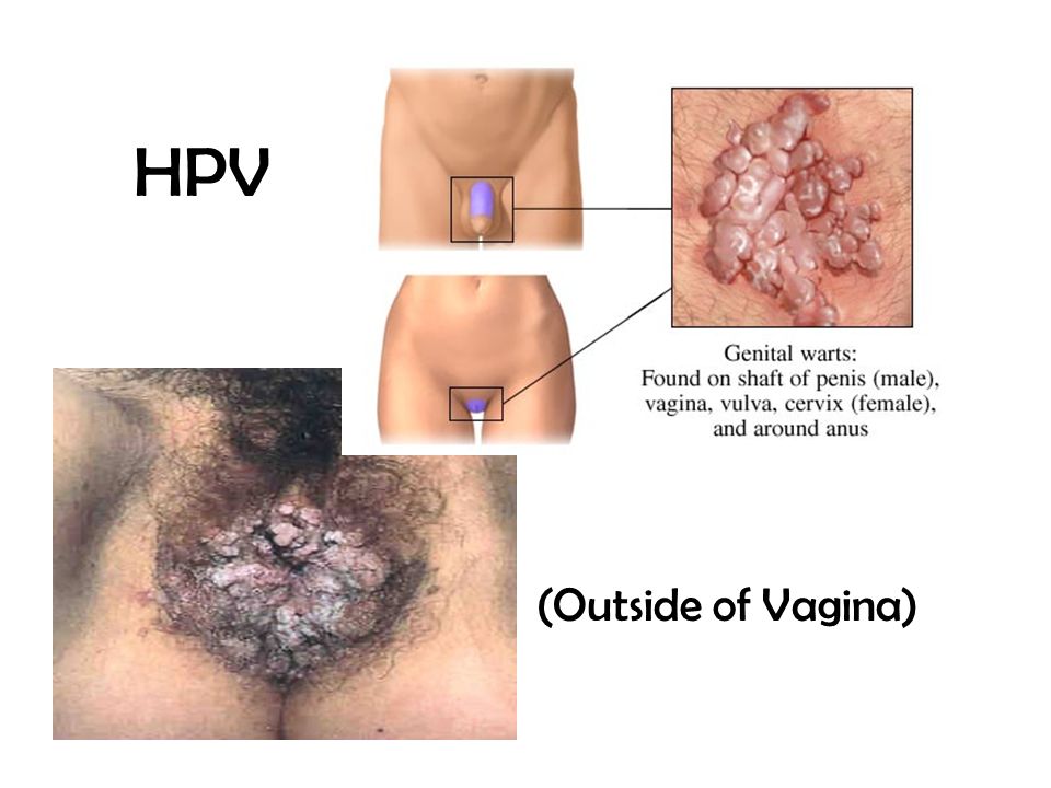 outside of the vagina Earley teen pussy