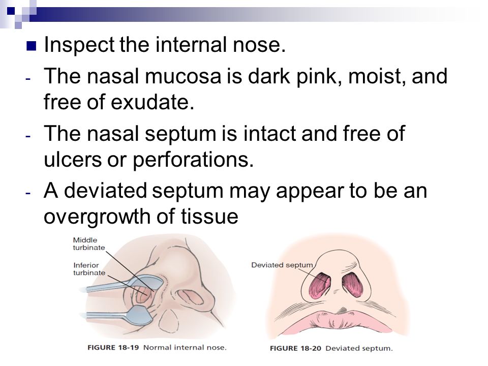Inspect the internal nose. - The nasal mucosa is dark pink, moist, and free of exudate.