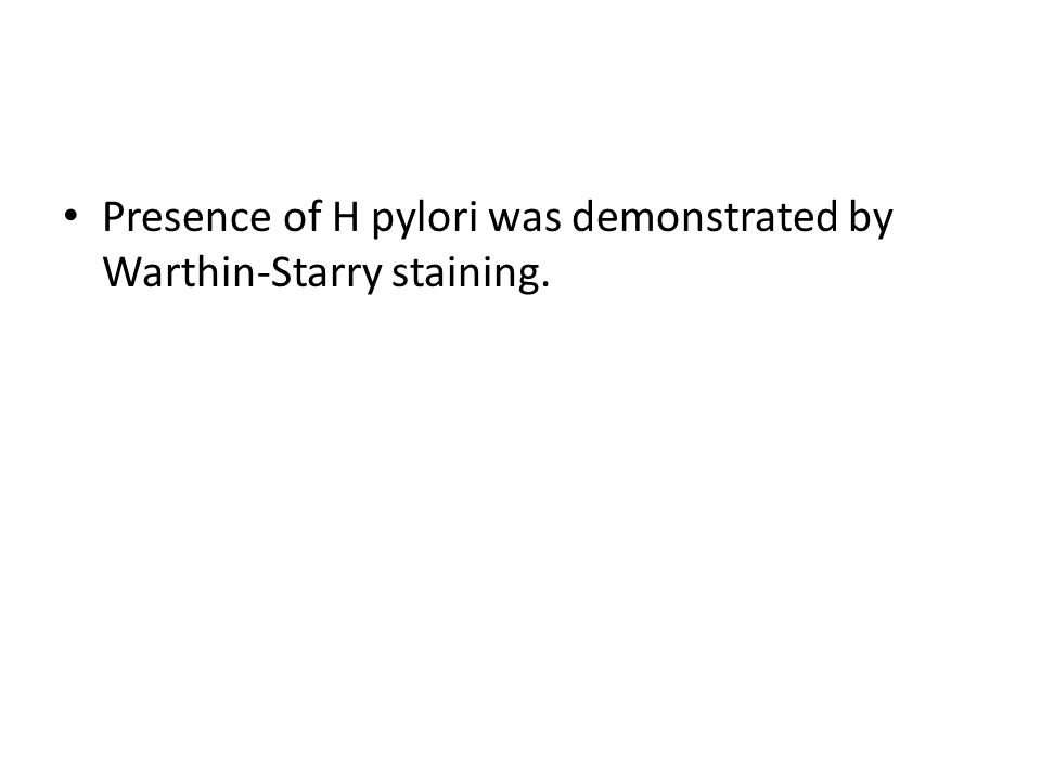Presence of H pylori was demonstrated by Warthin-Starry staining.