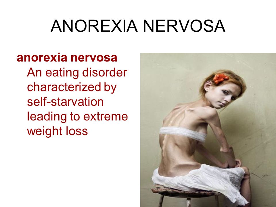 ANOREXIA NERVOSA anorexia nervosa An eating disorder characterized by self-starvation leading to extreme weight loss
