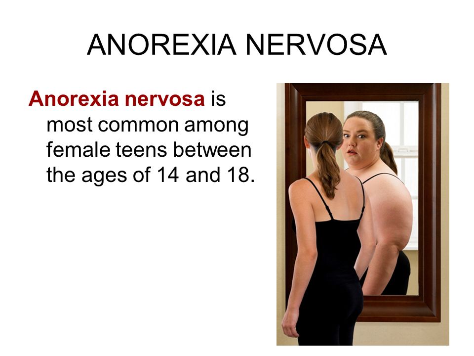 ANOREXIA NERVOSA Anorexia nervosa is most common among female teens between the ages of 14 and 18.