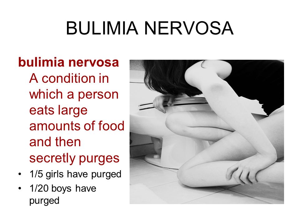 BULIMIA NERVOSA bulimia nervosa A condition in which a person eats large amounts of food and then secretly purges 1/5 girls have purged 1/20 boys have purged
