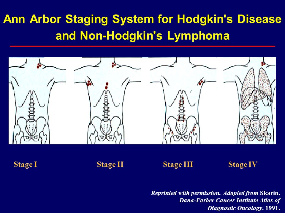 Ann Arbor Staging System for Hodgkin s Disease and