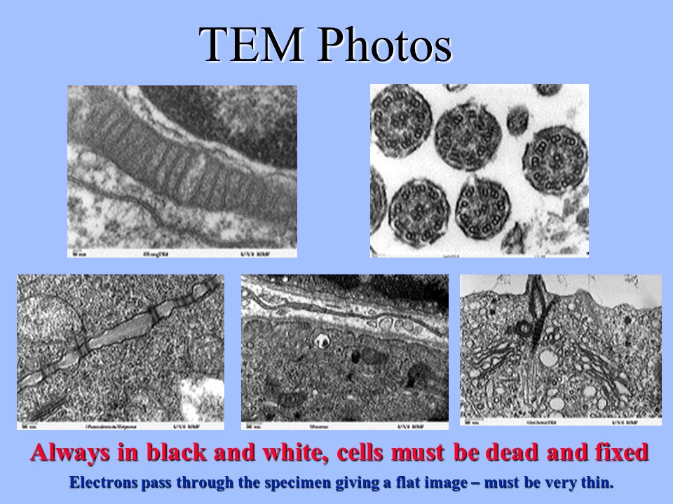 TEM Photos Always in black and white, cells must be dead and fixed Electrons pass through the specimen giving a flat image – must be very thin.
