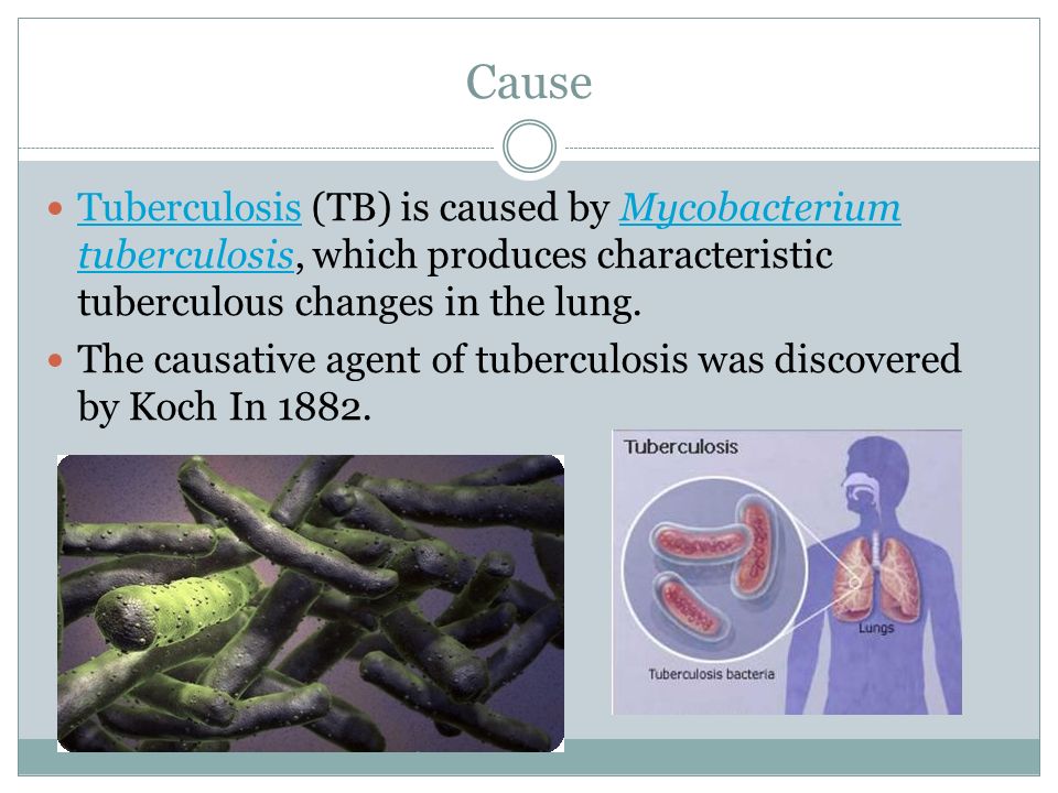 Environmental Science Essay Cause Tuberculosis Tb Is Caused By Mycobacterium Tuberculosis Which Produces Characteristic Tuberculous Changes Essay For Students Of High School also Who Can Help Me Write A Business Plan Theme Pulmonary Tuberculosis Essay Kazakh National Medical Best Essay Topics For High School
