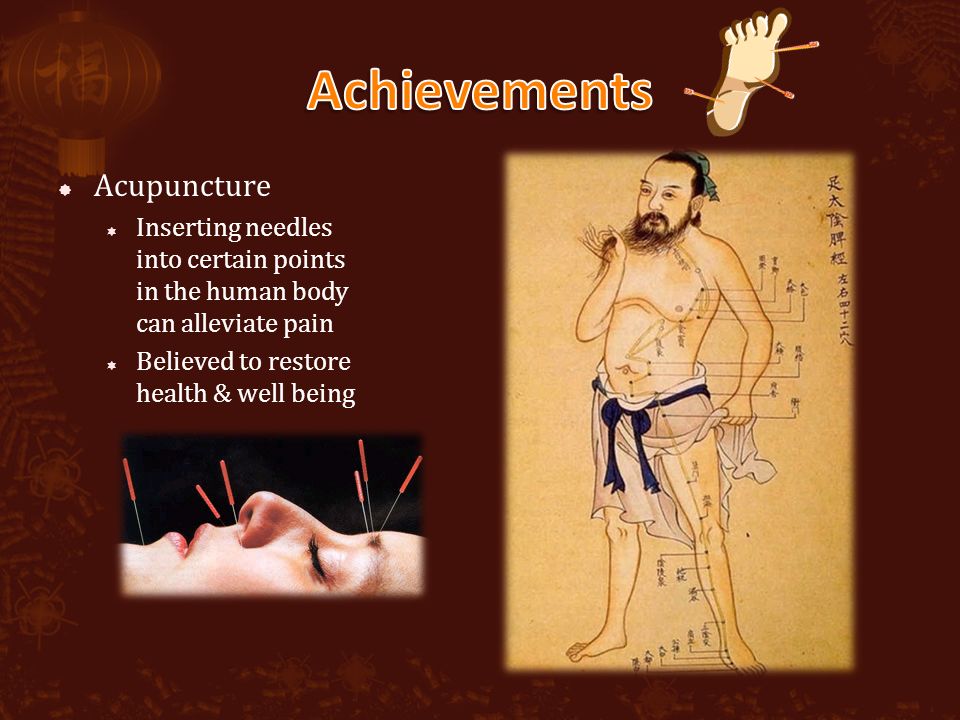  Acupuncture  Inserting needles into certain points in the human body can alleviate pain  Believed to restore health & well being