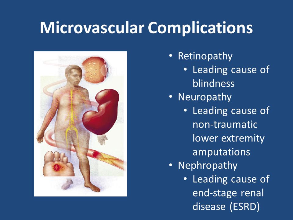 Microvascular Complications Retinopathy Leading cause of blindness Neuropathy Leading cause of non-traumatic lower extremity amputations Nephropathy Leading cause of end-stage renal disease (ESRD)