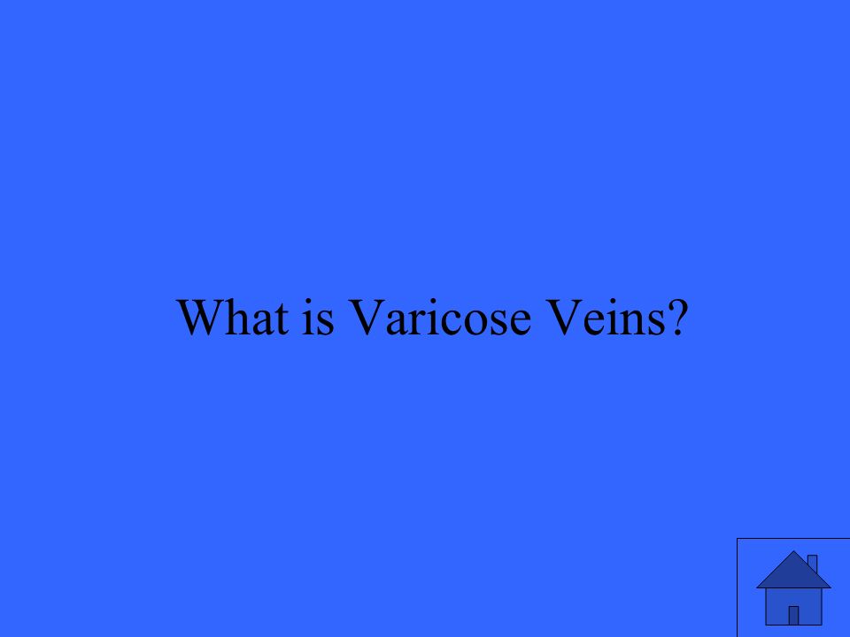 49 What is Varicose Veins
