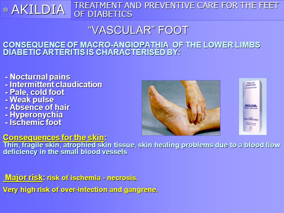 diabetes angiopathia a diabetes mellitus kezelése 2. típusú bemutatása