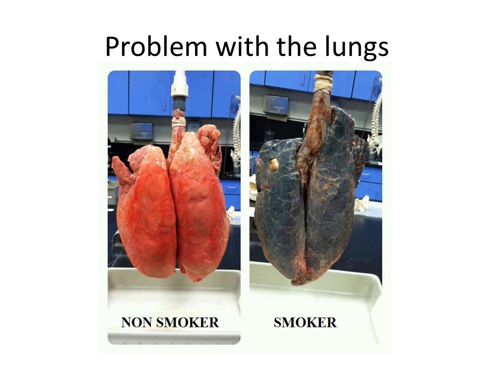 Problem with the lungs