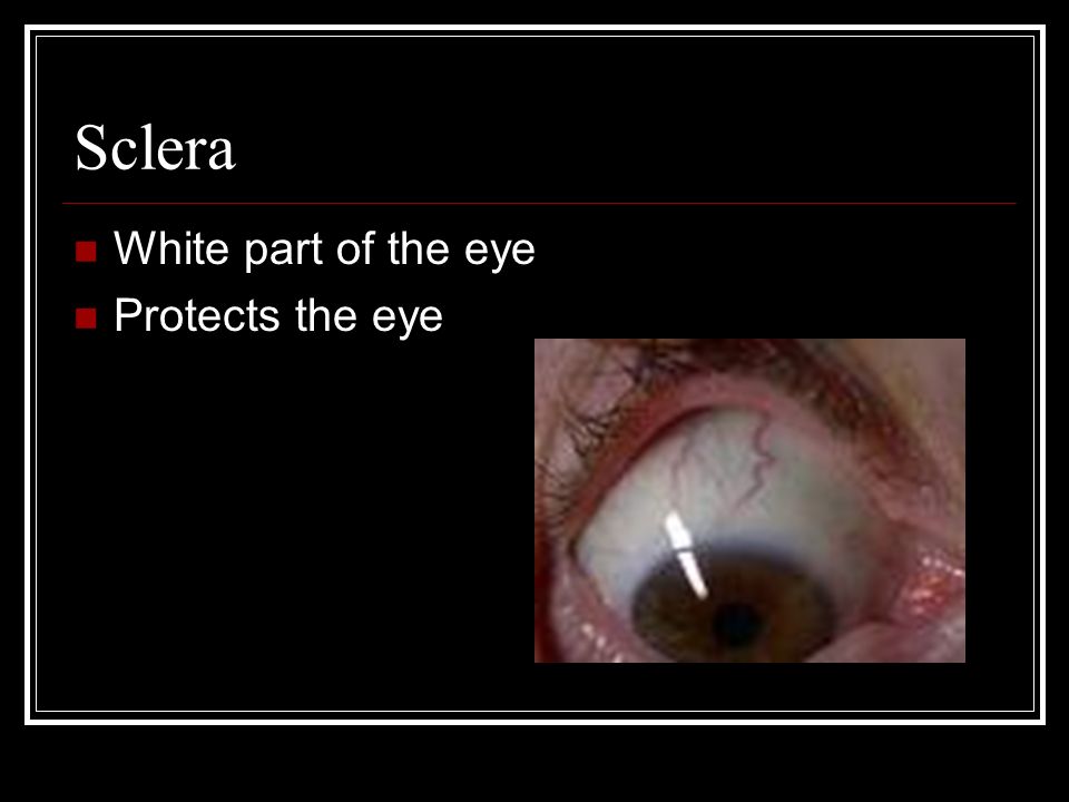 Sclera White part of the eye Protects the eye