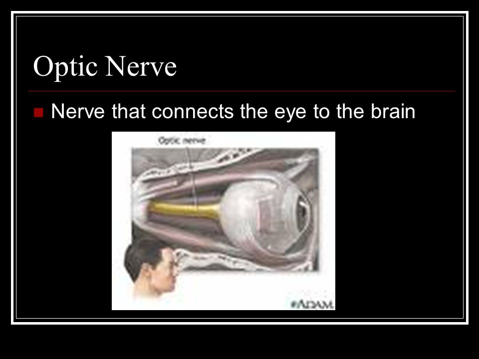 Optic Nerve Nerve that connects the eye to the brain