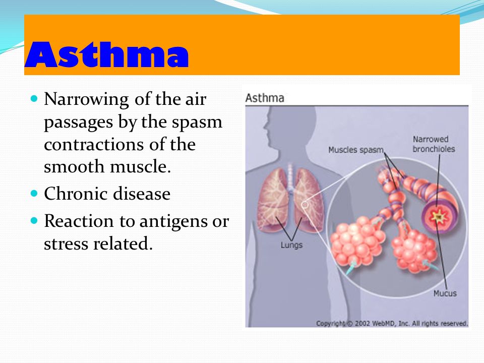 Asthma Narrowing of the air passages by the spasm contractions of the smooth muscle.