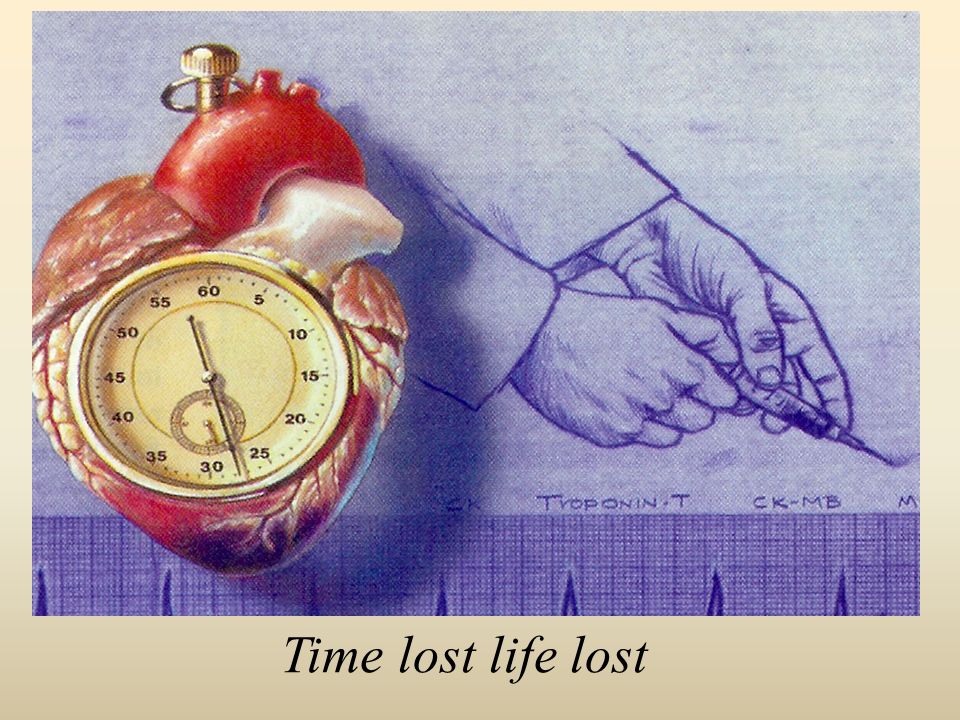 Time lost life lost