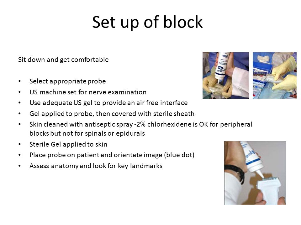 Set up of block Sit down and get comfortable Select appropriate probe US machine set for nerve examination Use adequate US gel to provide an air free interface Gel applied to probe, then covered with sterile sheath Skin cleaned with antiseptic spray -2% chlorhexidene is OK for peripheral blocks but not for spinals or epidurals Sterile Gel applied to skin Place probe on patient and orientate image (blue dot) Assess anatomy and look for key landmarks