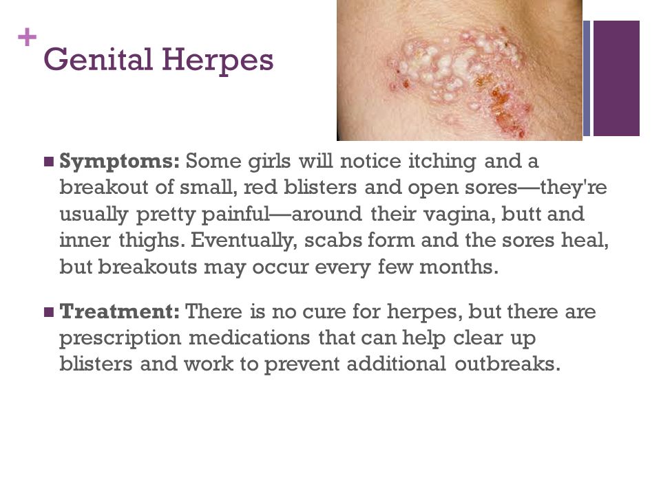 + Genital Herpes Symptoms: Some girls will notice itching and a breakout of...