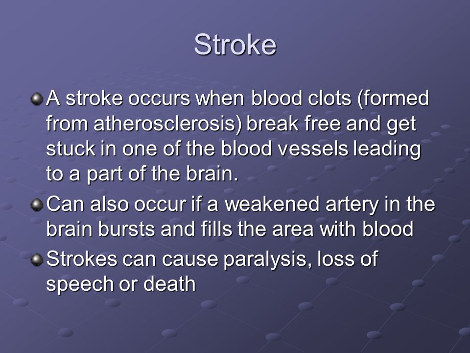 Stroke A stroke occurs when blood clots (formed from atherosclerosis) break free and get stuck in one of the blood vessels leading to a part of the brain.