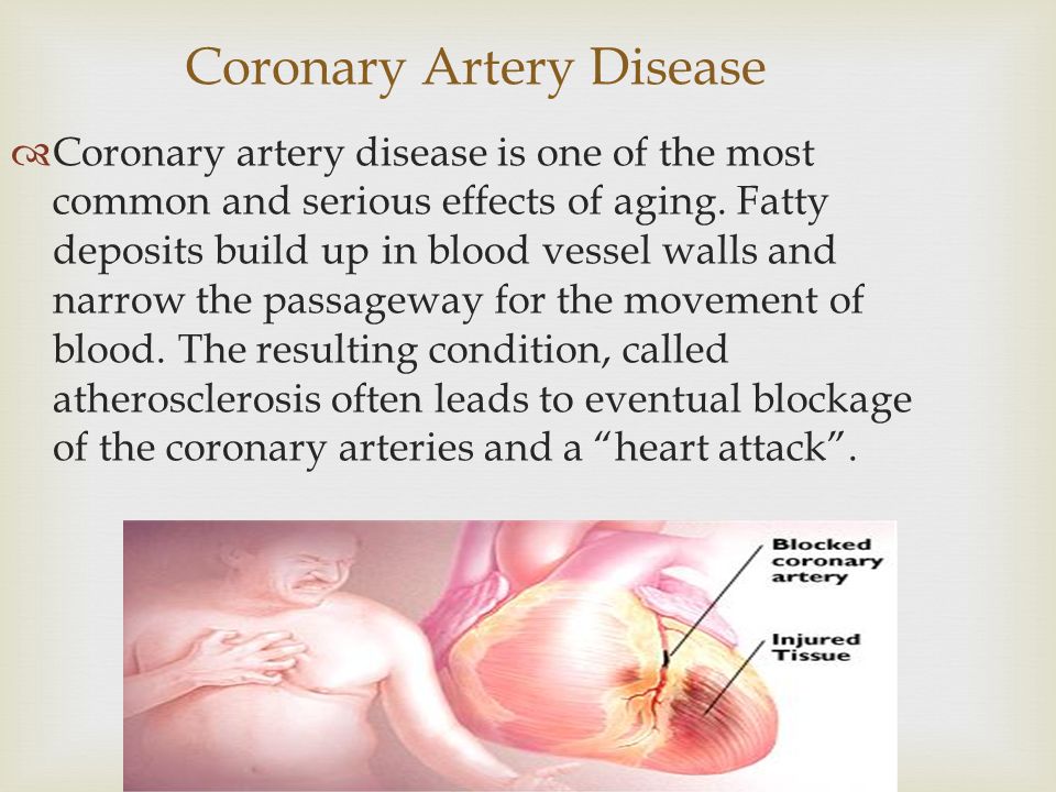 Coronary Artery Disease  Coronary artery disease is one of the most common and serious effects of aging.