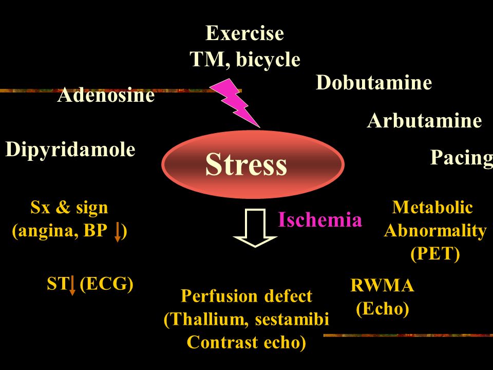 Old and New Stress Agent 계명의대 김기식. Ischemic cascade Myocardial ischemia  Diastolic dysfunction Regional systolic dysfunction ECG changes Chest pain.  - ppt download
