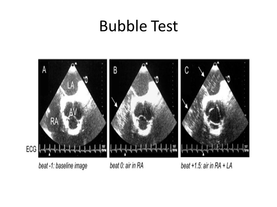 Bubble Test