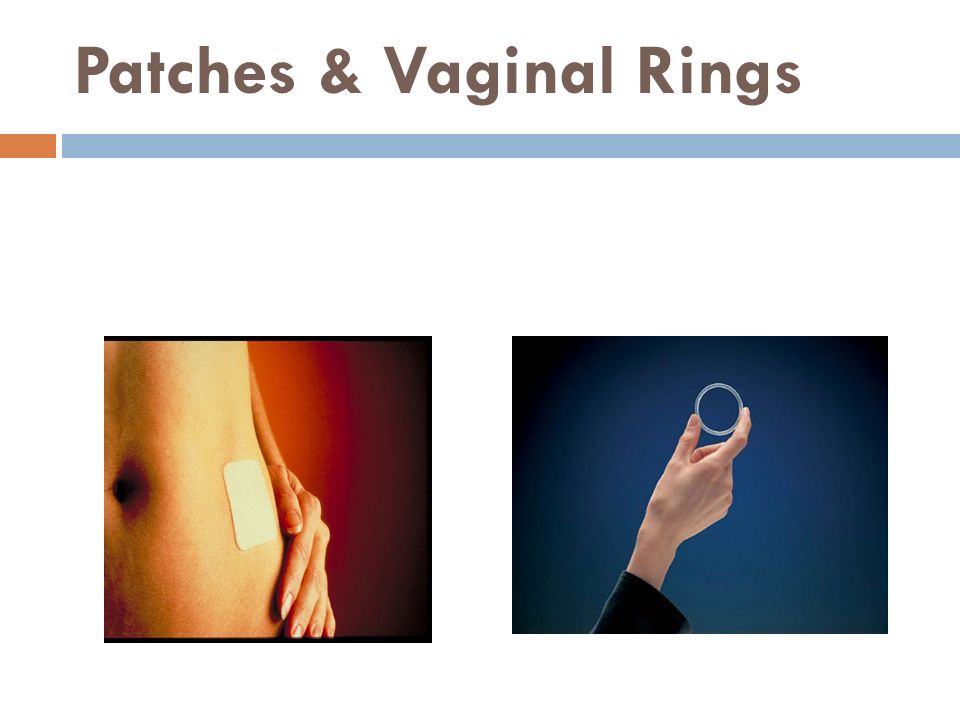 Patches & Vaginal Rings