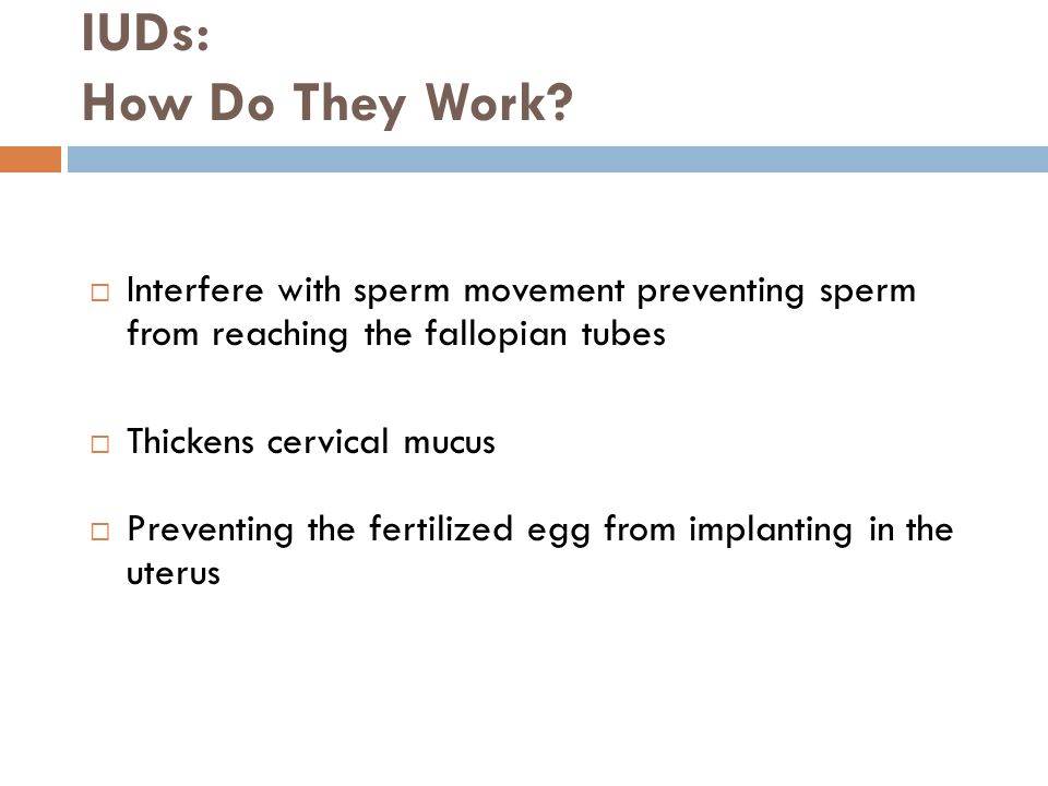IUDs: How Do They Work.