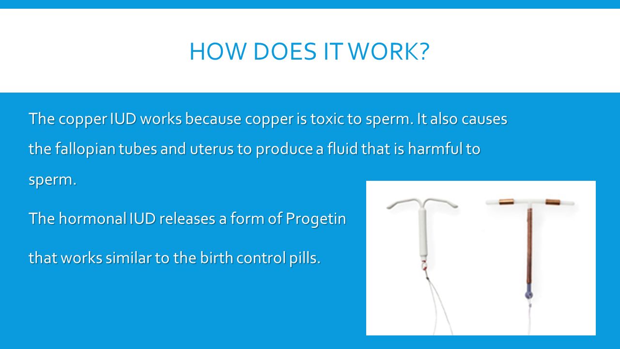 HOW DOES IT WORK. The copper IUD works because copper is toxic to sperm.